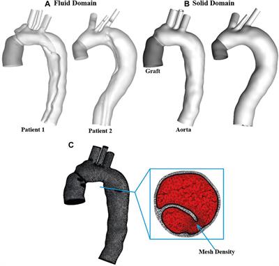 Fluid-Structure Interaction Simulations of Repaired Type A Aortic Dissection: a Comprehensive Comparison With Rigid Wall Models